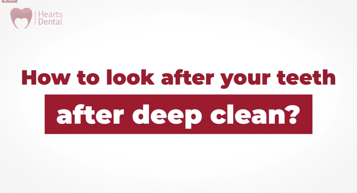 How to look after your teeth after deep clean